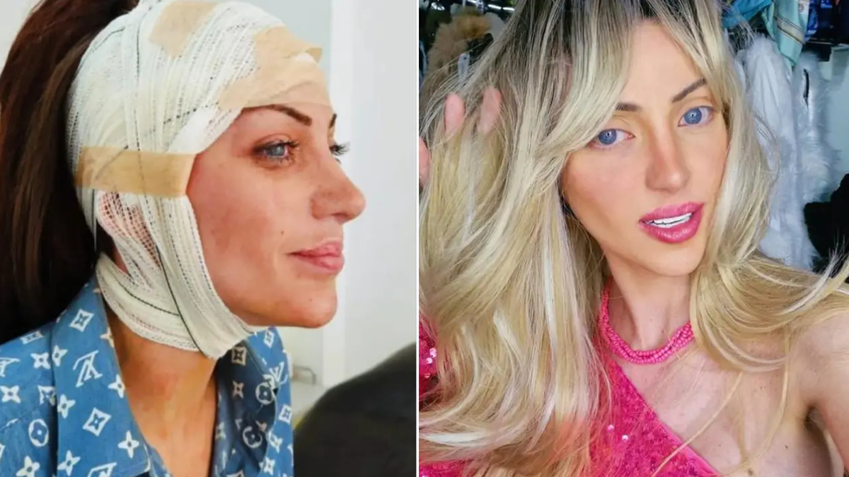 barbie bebege benzemek icin 27 kez ameliyat oldu brezilyali fenomen 31 yasinda hayatini kaybetti YArImvyv.jpg
