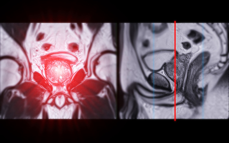 Haber gorseli